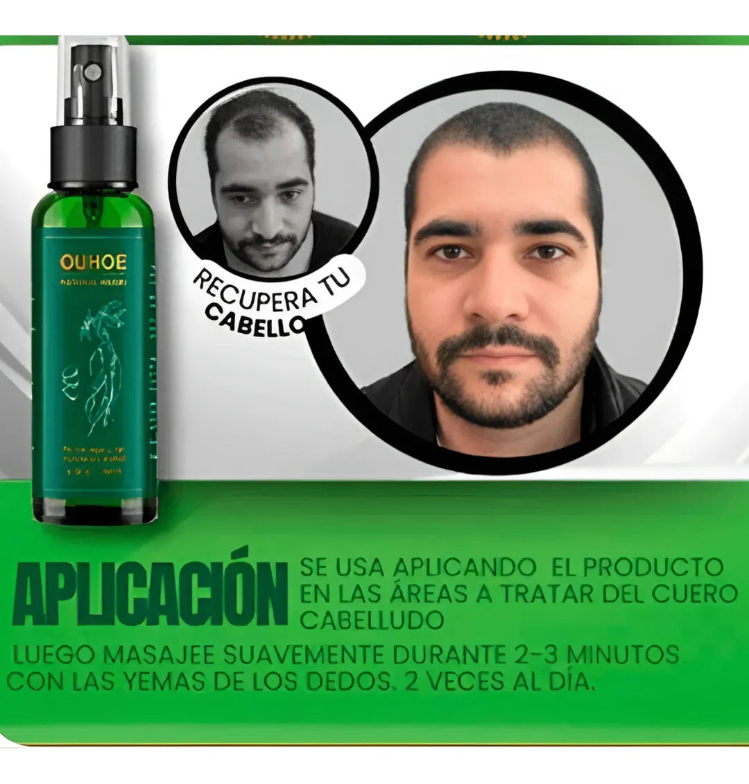 OUHOE SPRAY TONICO CAPILAR