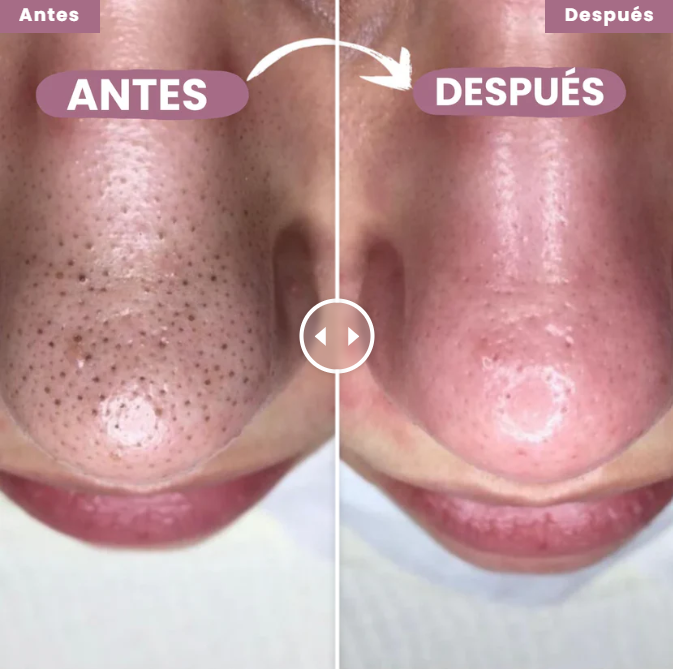 COMBO EXFOLIANT BLACK RICE , WHITE RICE