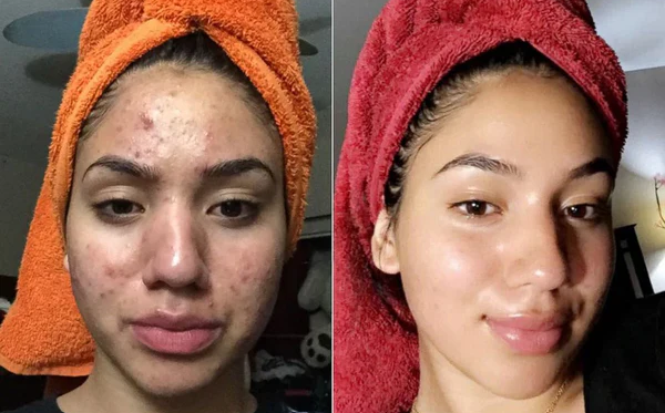 COMBO EXFOLIANT BLACK RICE , WHITE RICE