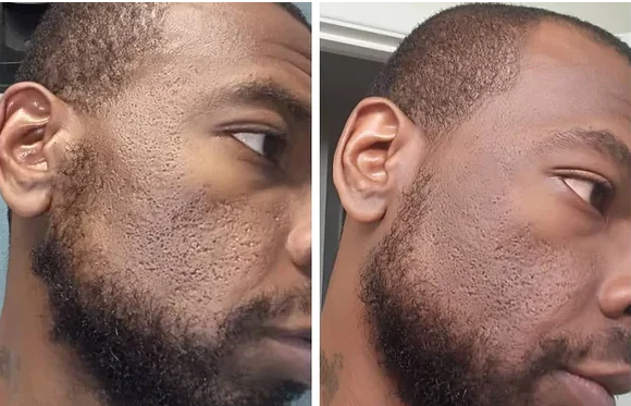 COMBO EXFOLIANT BLACK RICE , WHITE RICE