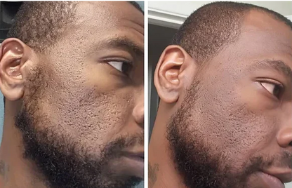 COMBO EXFOLIANT BLACK RICE , WHITE RICE