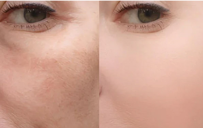 COMBO EXFOLIANT BLACK RICE , WHITE RICE