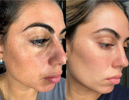 COMBO EXFOLIANT BLACK RICE , WHITE RICE