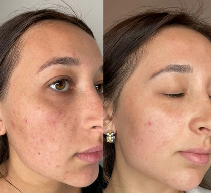 COMBO EXFOLIANT BLACK RICE , WHITE RICE